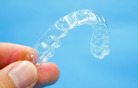 マウスピース矯正