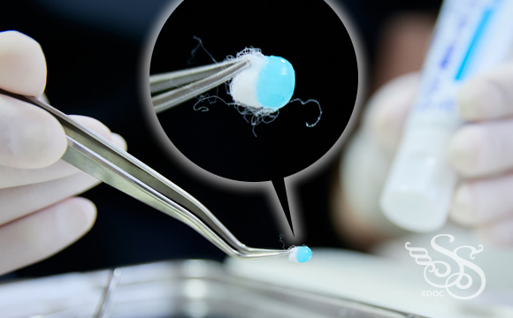 表面麻酔ジェル